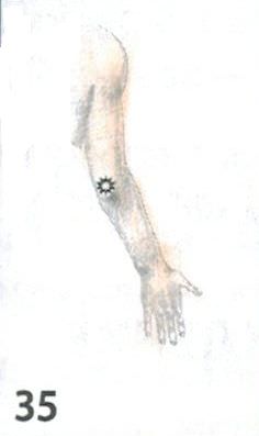 p35