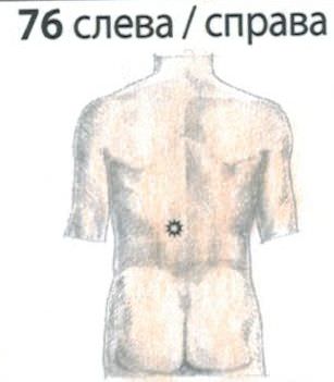 p76